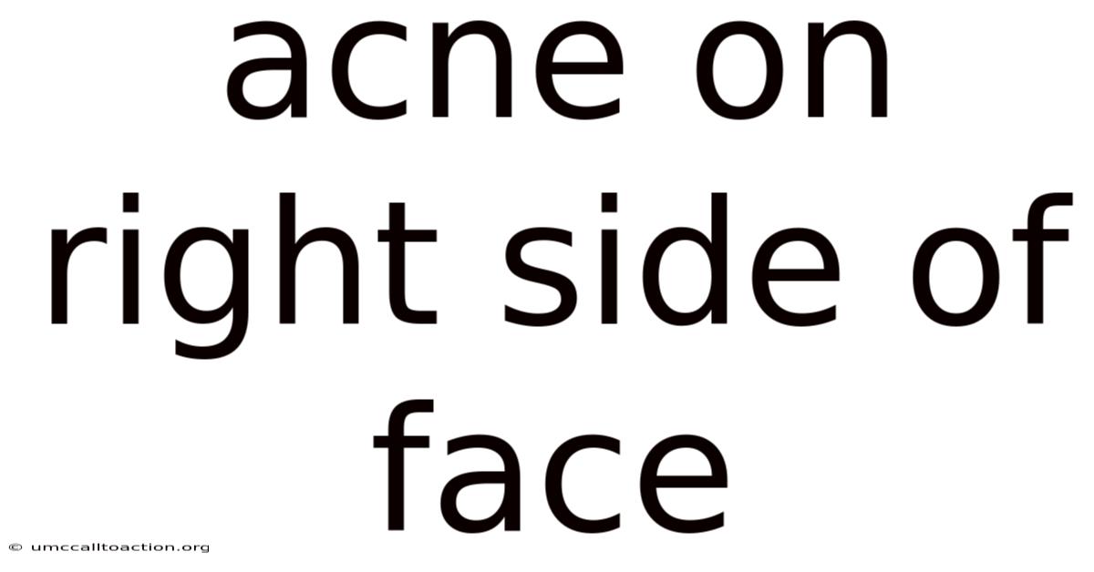 Acne On Right Side Of Face
