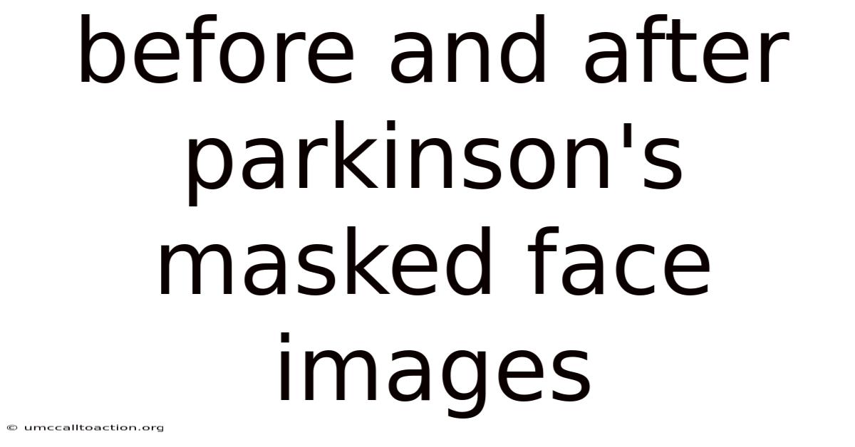 Before And After Parkinson's Masked Face Images