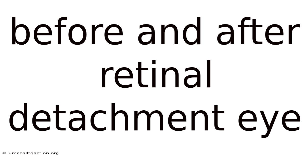 Before And After Retinal Detachment Eye
