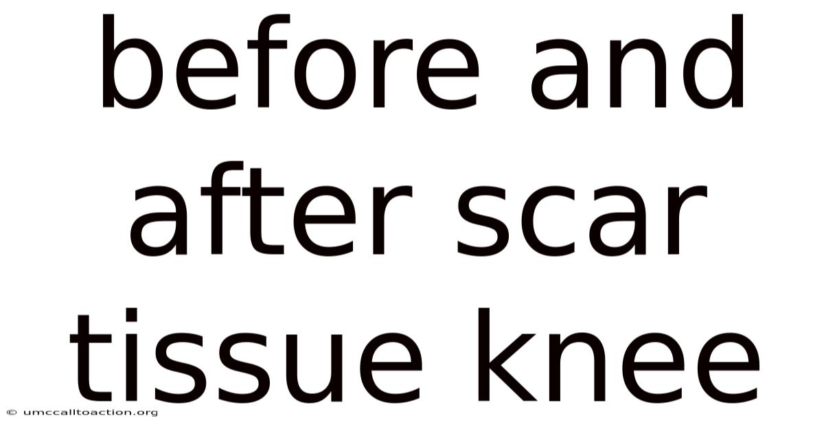 Before And After Scar Tissue Knee