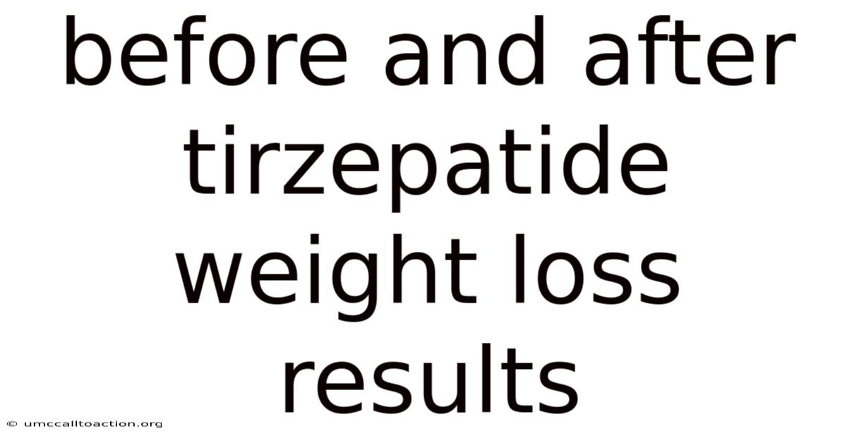 Before And After Tirzepatide Weight Loss Results
