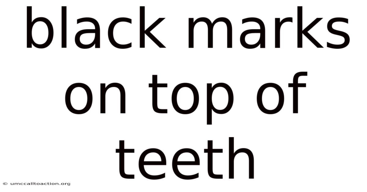 Black Marks On Top Of Teeth