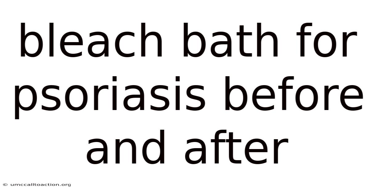 Bleach Bath For Psoriasis Before And After