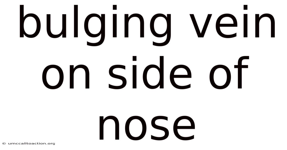 Bulging Vein On Side Of Nose