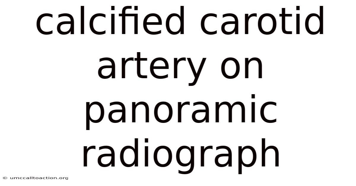 Calcified Carotid Artery On Panoramic Radiograph