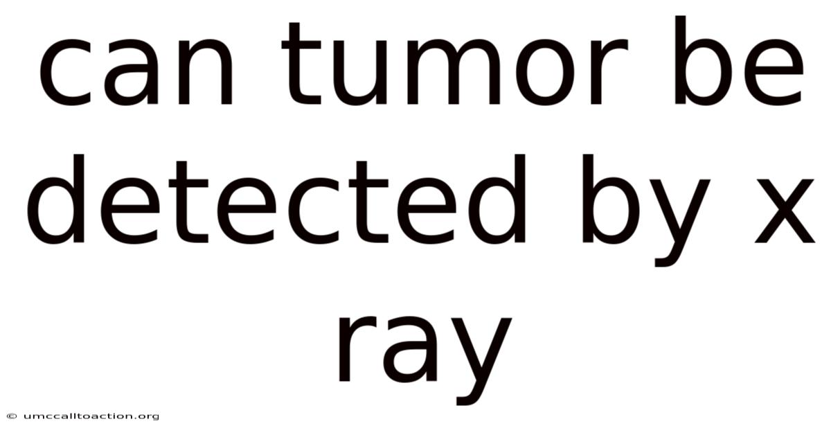 Can Tumor Be Detected By X Ray