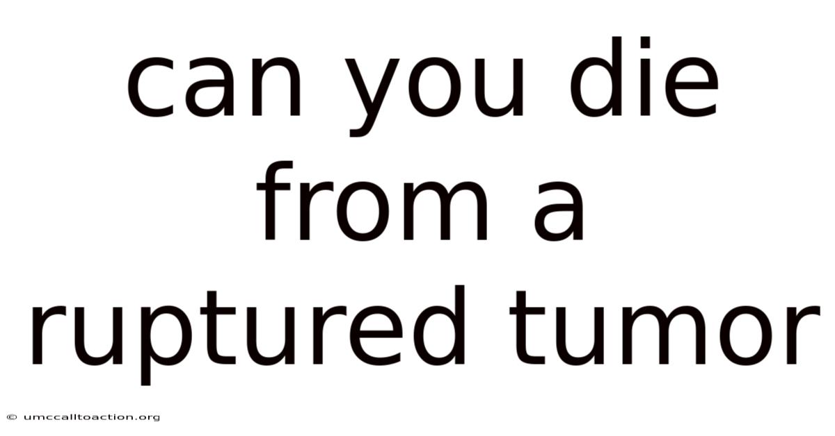 Can You Die From A Ruptured Tumor