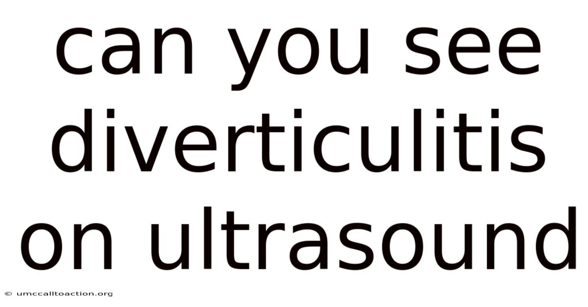 Can You See Diverticulitis On Ultrasound