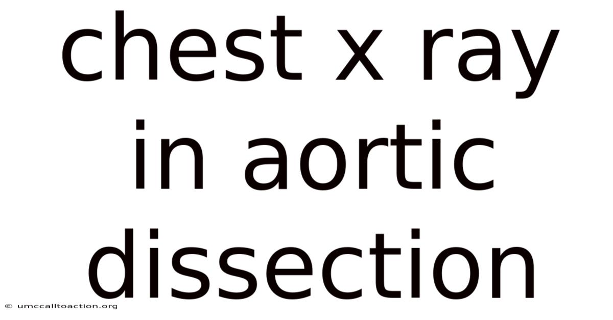 Chest X Ray In Aortic Dissection