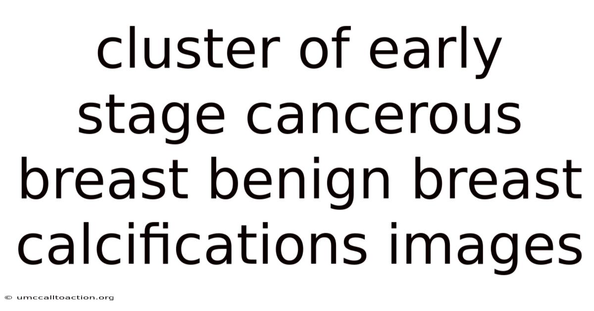 Cluster Of Early Stage Cancerous Breast Benign Breast Calcifications Images