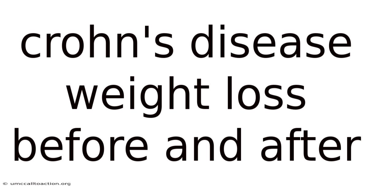 Crohn's Disease Weight Loss Before And After