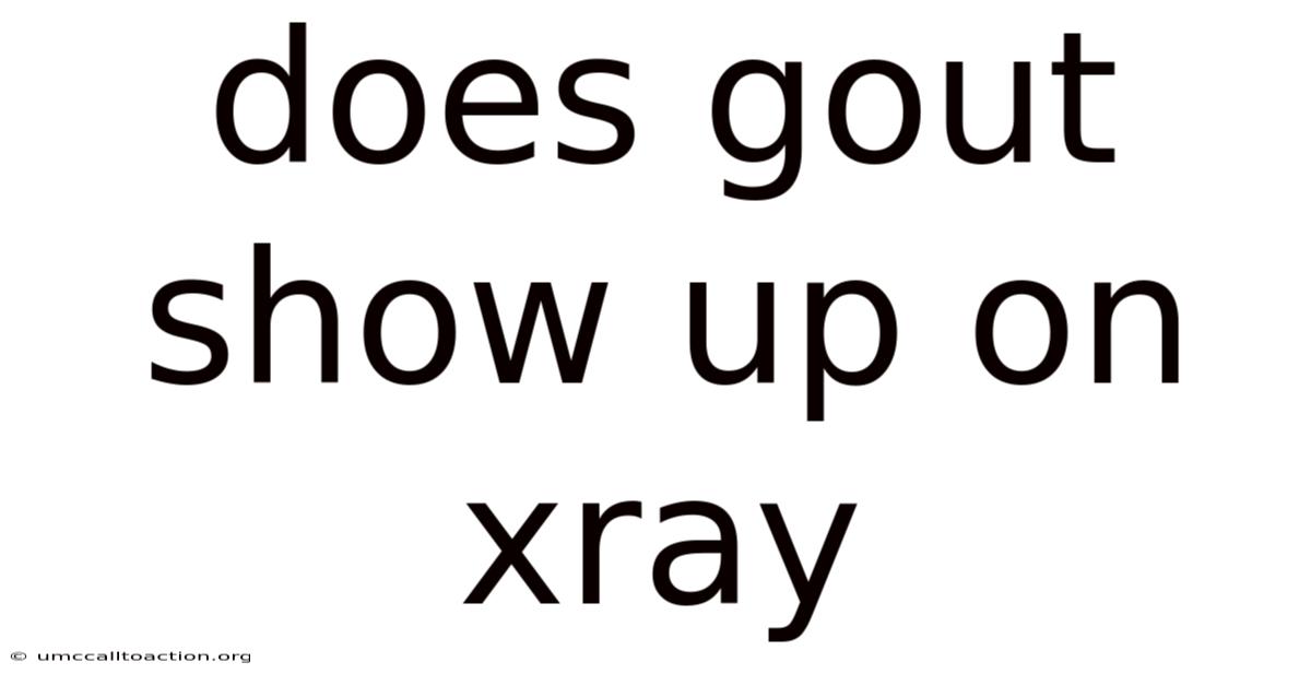 Does Gout Show Up On Xray