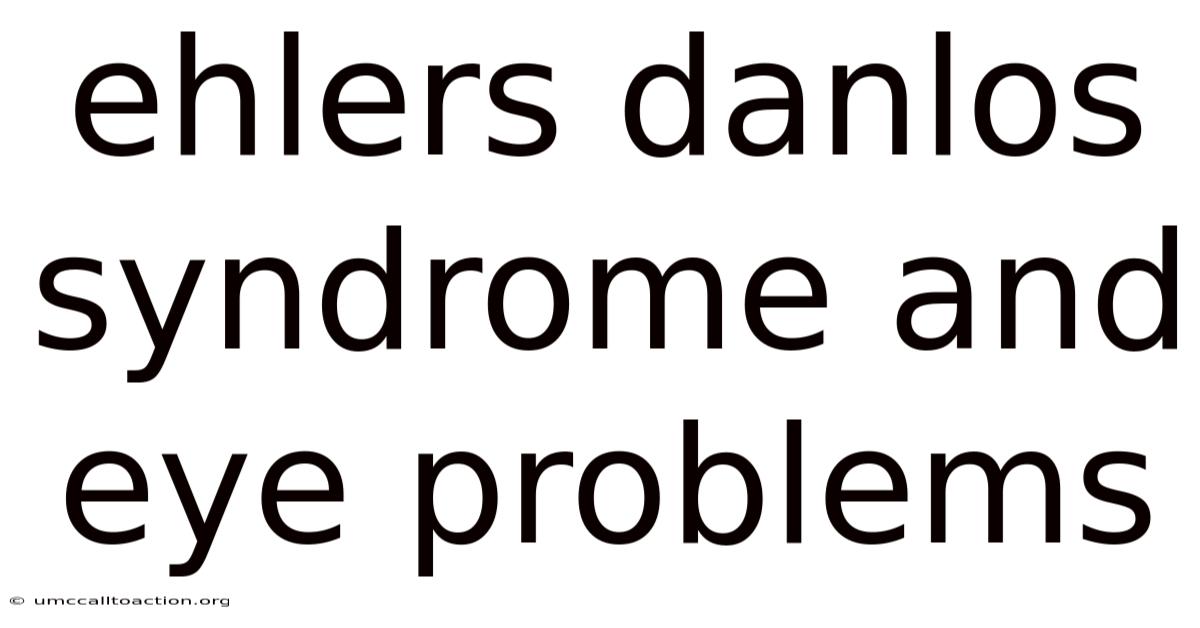 Ehlers Danlos Syndrome And Eye Problems