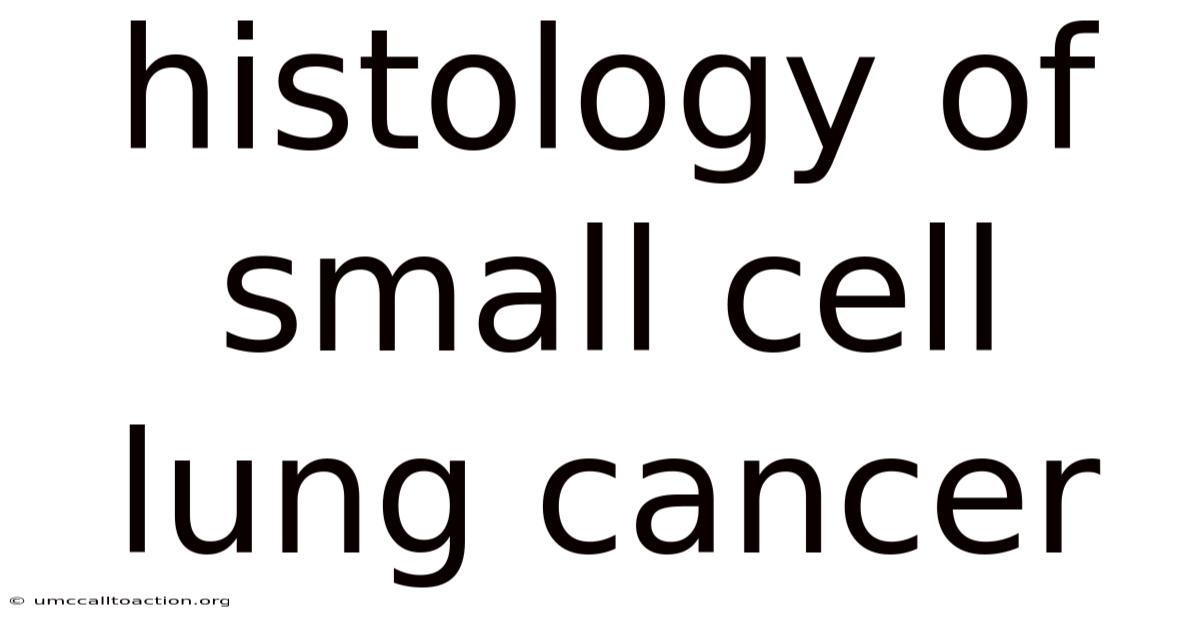 Histology Of Small Cell Lung Cancer