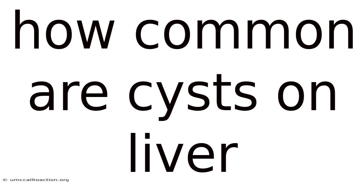 How Common Are Cysts On Liver