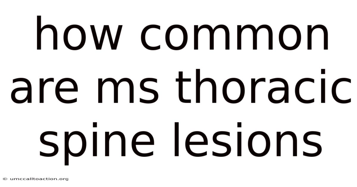 How Common Are Ms Thoracic Spine Lesions