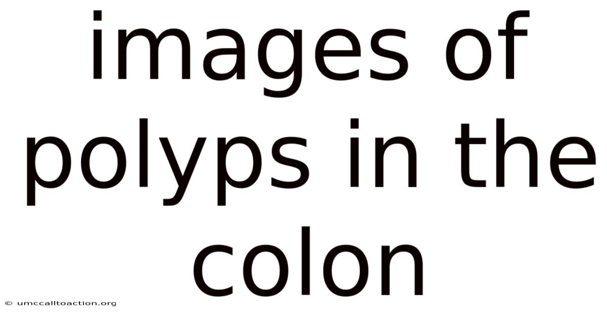 Images Of Polyps In The Colon