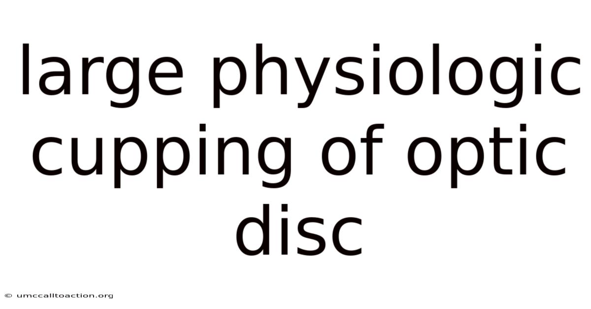 Large Physiologic Cupping Of Optic Disc