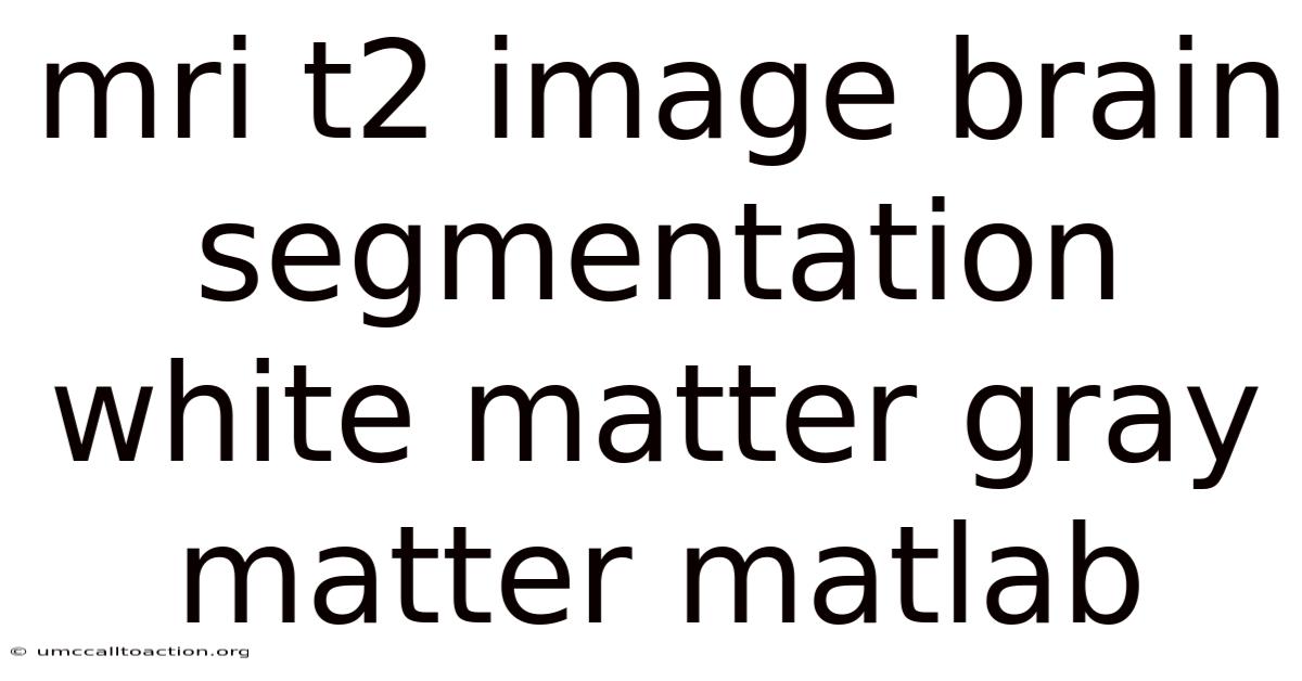 Mri T2 Image Brain Segmentation White Matter Gray Matter Matlab