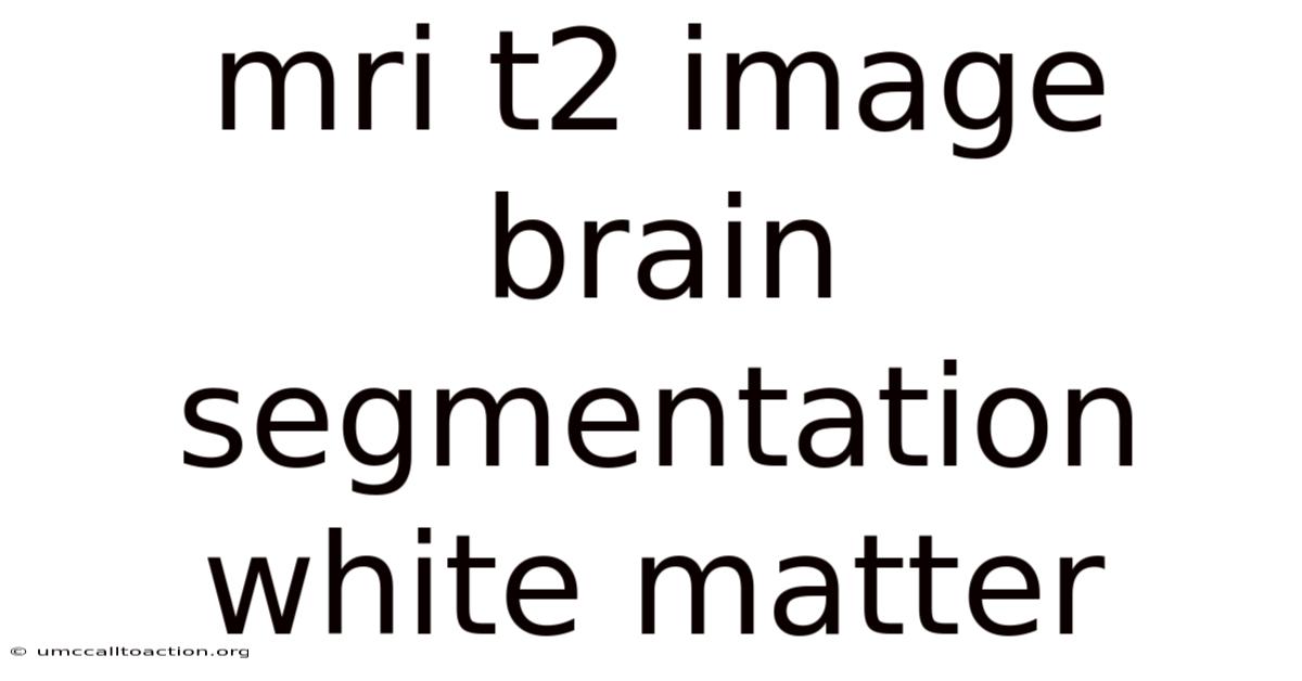 Mri T2 Image Brain Segmentation White Matter