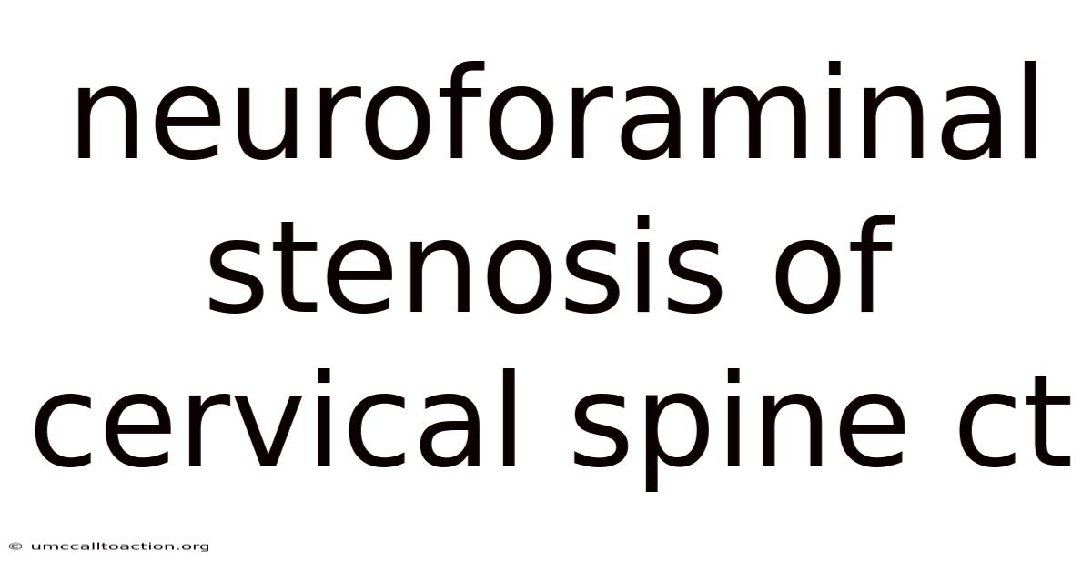 Neuroforaminal Stenosis Of Cervical Spine Ct