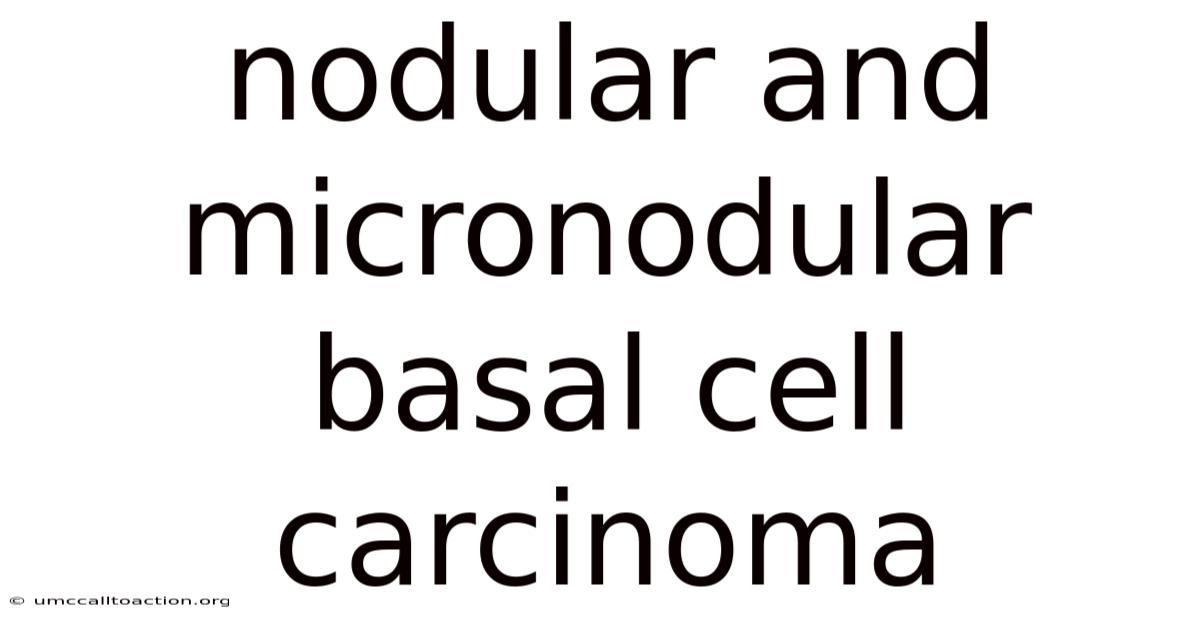 Nodular And Micronodular Basal Cell Carcinoma
