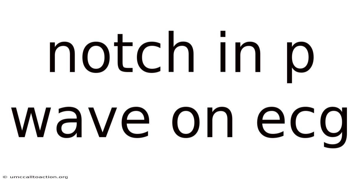 Notch In P Wave On Ecg