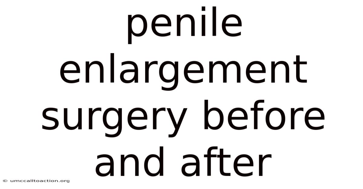 Penile Enlargement Surgery Before And After