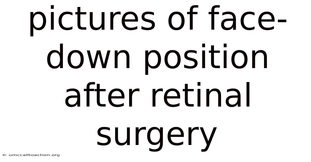 Pictures Of Face-down Position After Retinal Surgery