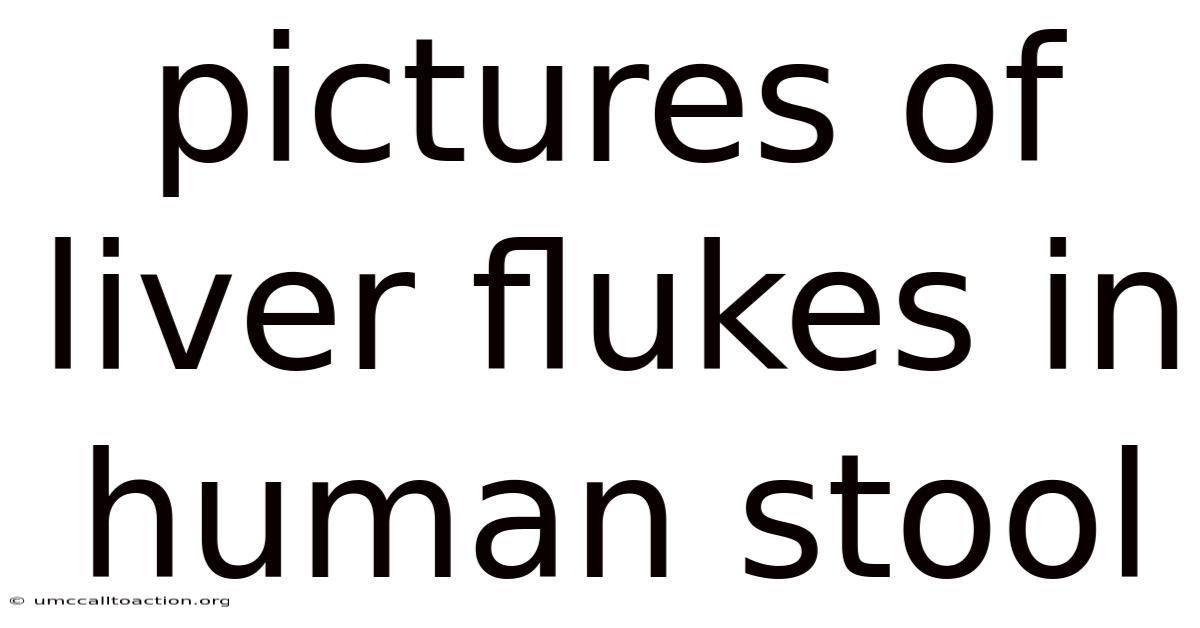 Pictures Of Liver Flukes In Human Stool