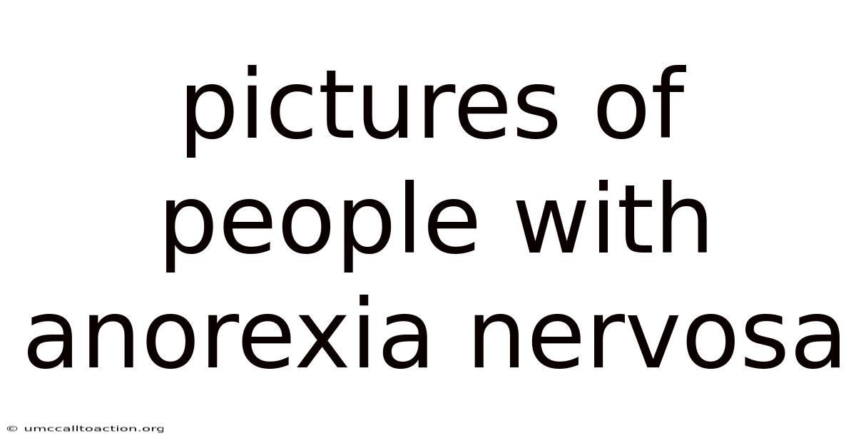 Pictures Of People With Anorexia Nervosa