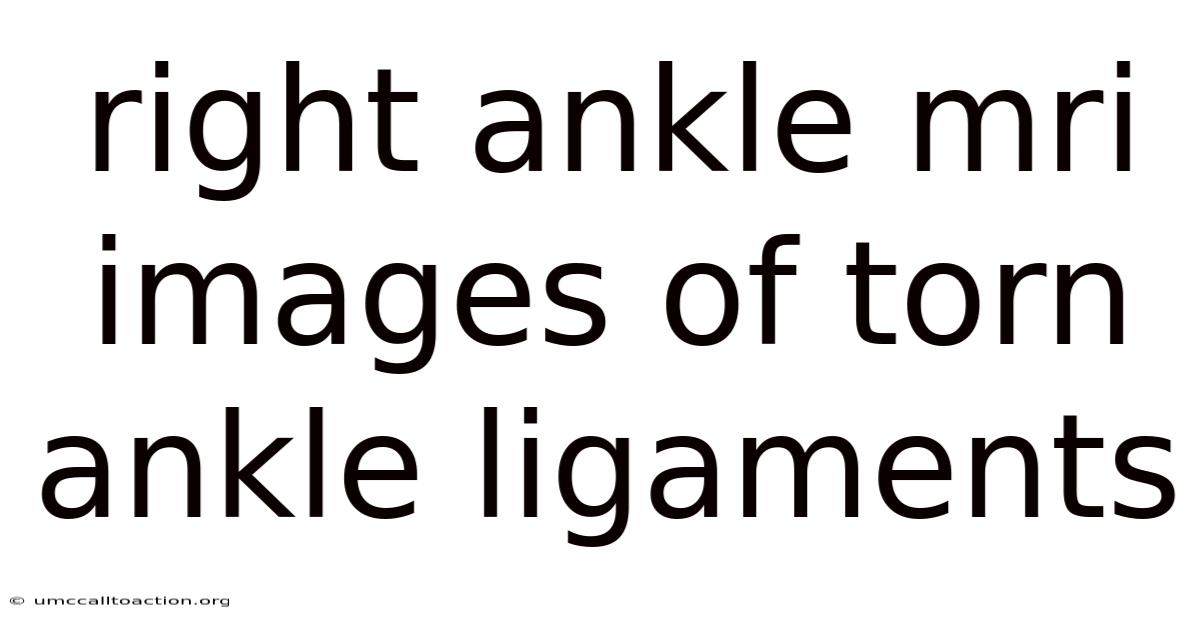 Right Ankle Mri Images Of Torn Ankle Ligaments
