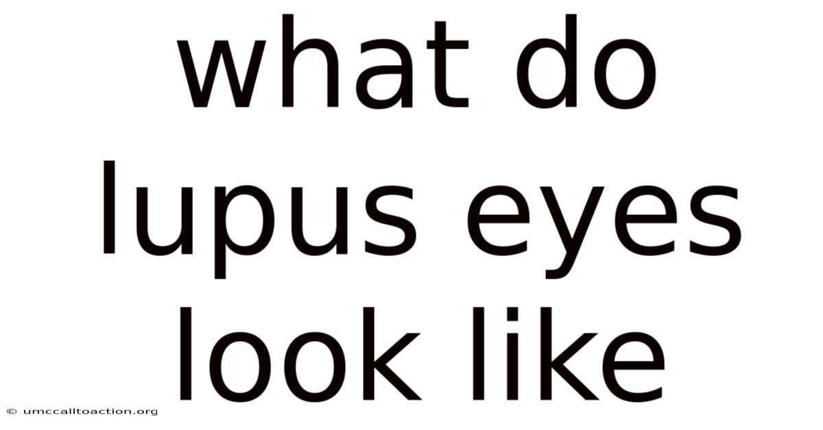 What Do Lupus Eyes Look Like