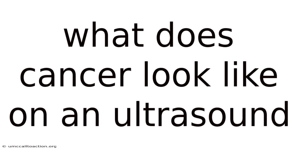What Does Cancer Look Like On An Ultrasound