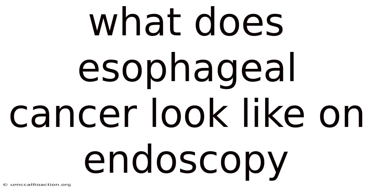 What Does Esophageal Cancer Look Like On Endoscopy
