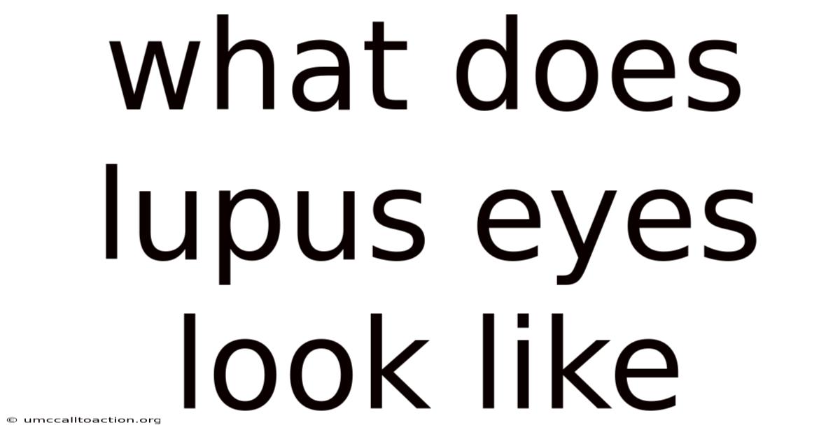 What Does Lupus Eyes Look Like