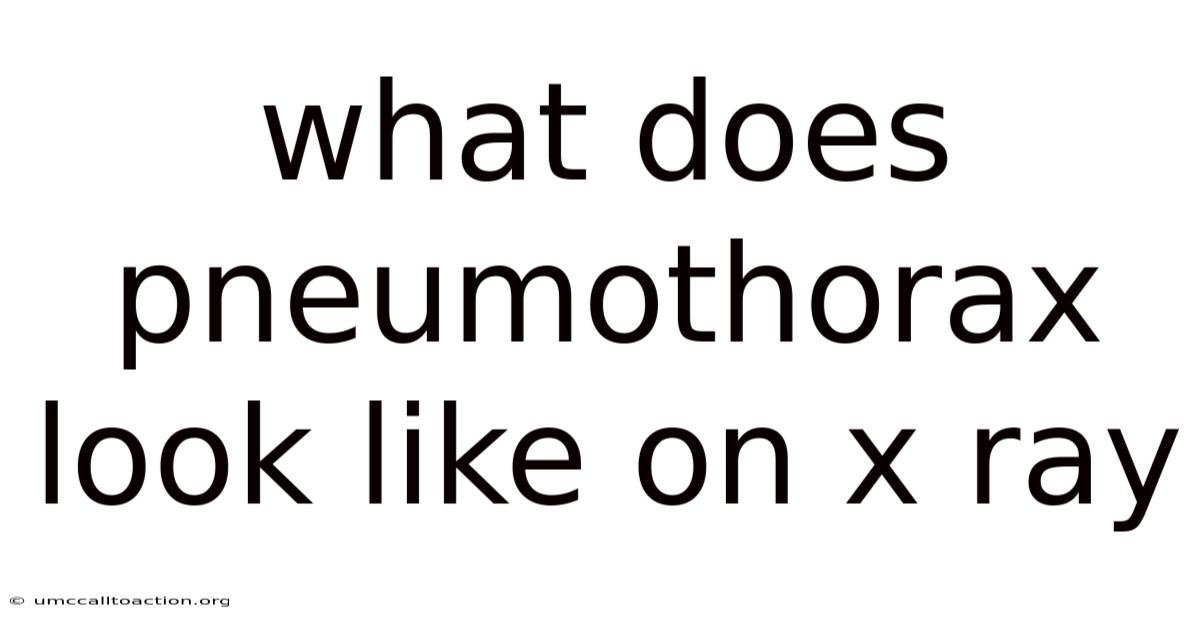 What Does Pneumothorax Look Like On X Ray