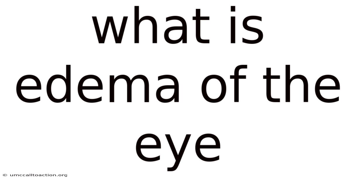 What Is Edema Of The Eye