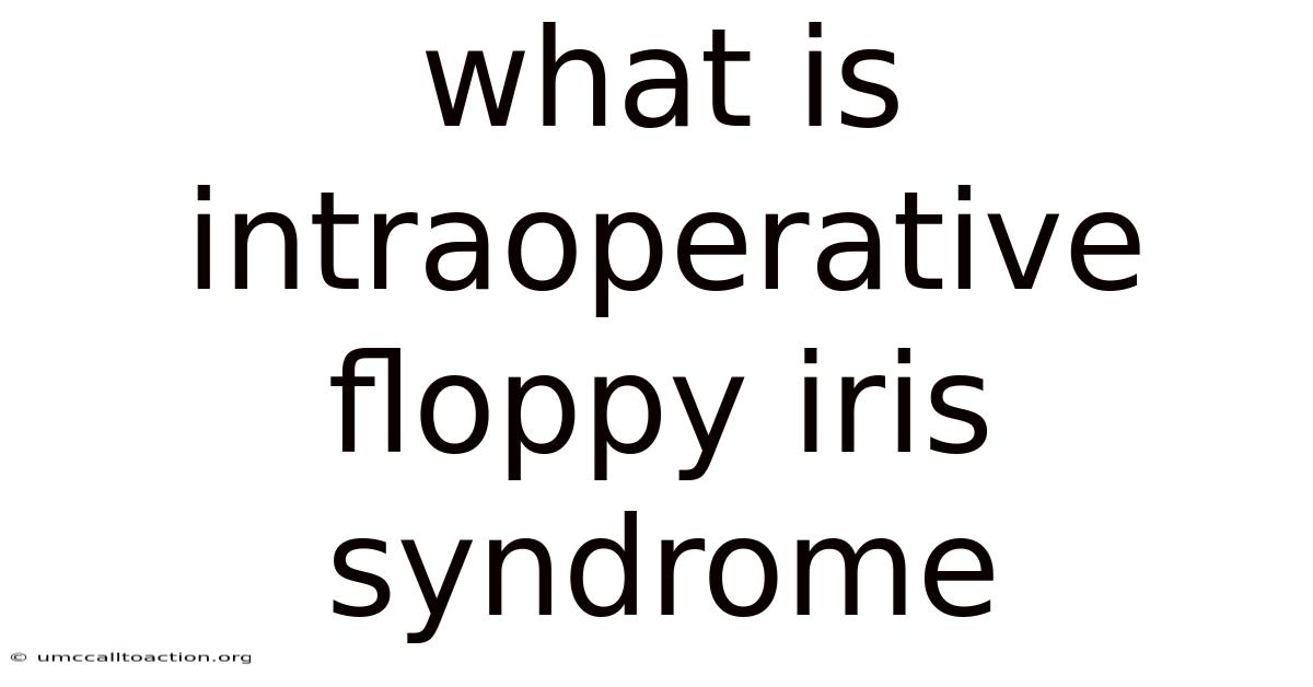 What Is Intraoperative Floppy Iris Syndrome
