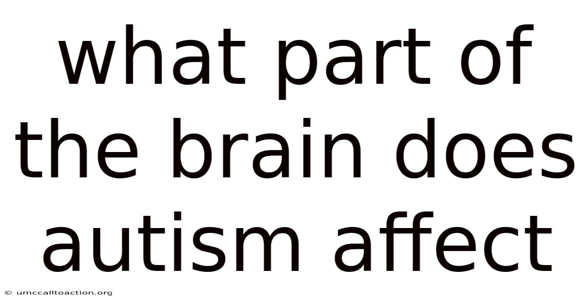 What Part Of The Brain Does Autism Affect