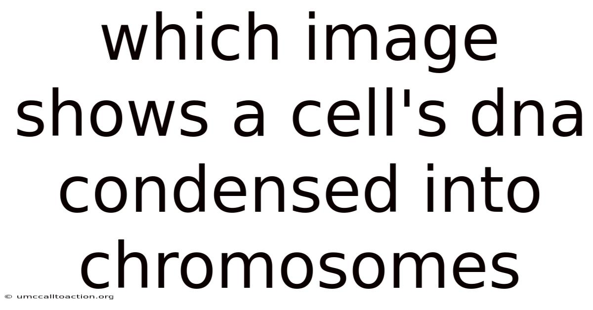 Which Image Shows A Cell's Dna Condensed Into Chromosomes