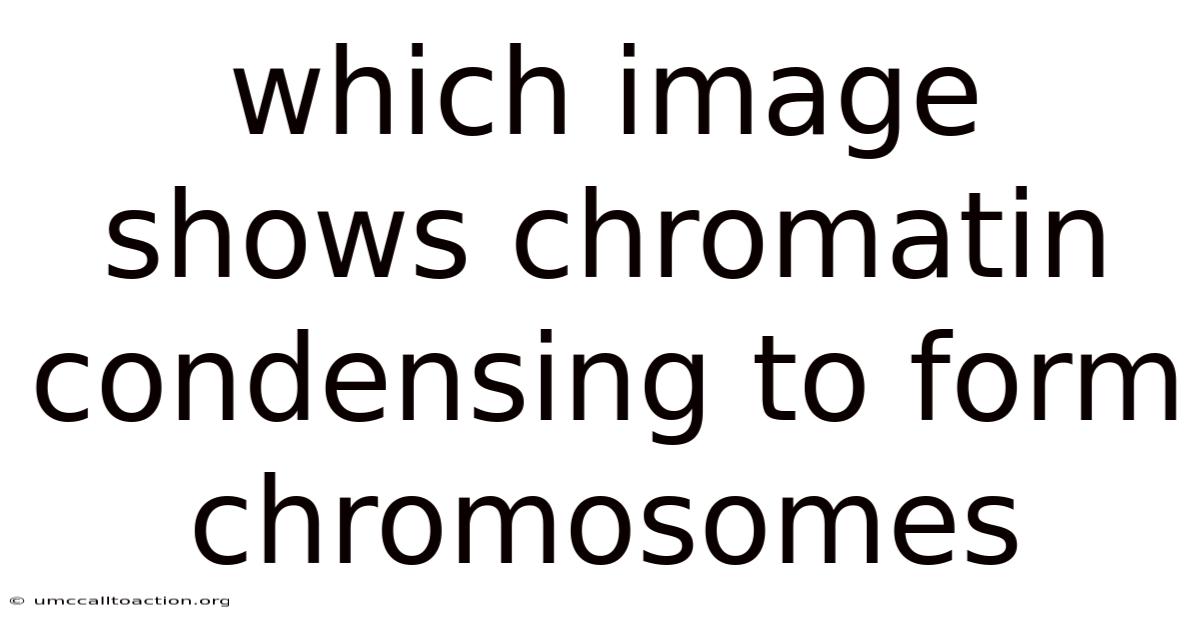 Which Image Shows Chromatin Condensing To Form Chromosomes