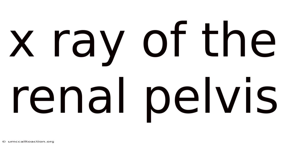 X Ray Of The Renal Pelvis